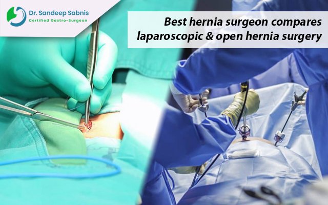 best-hernia-surgeon-compares-laparoscopic-open-hernia-surgery